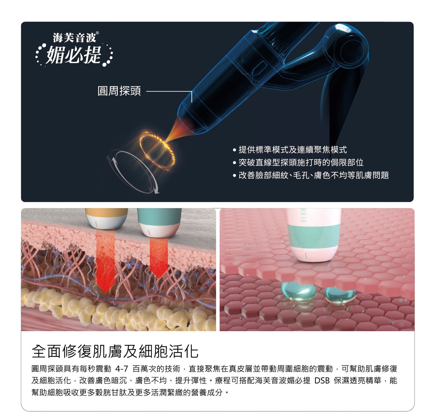 Introduction to Ultraformer MPT circular probes