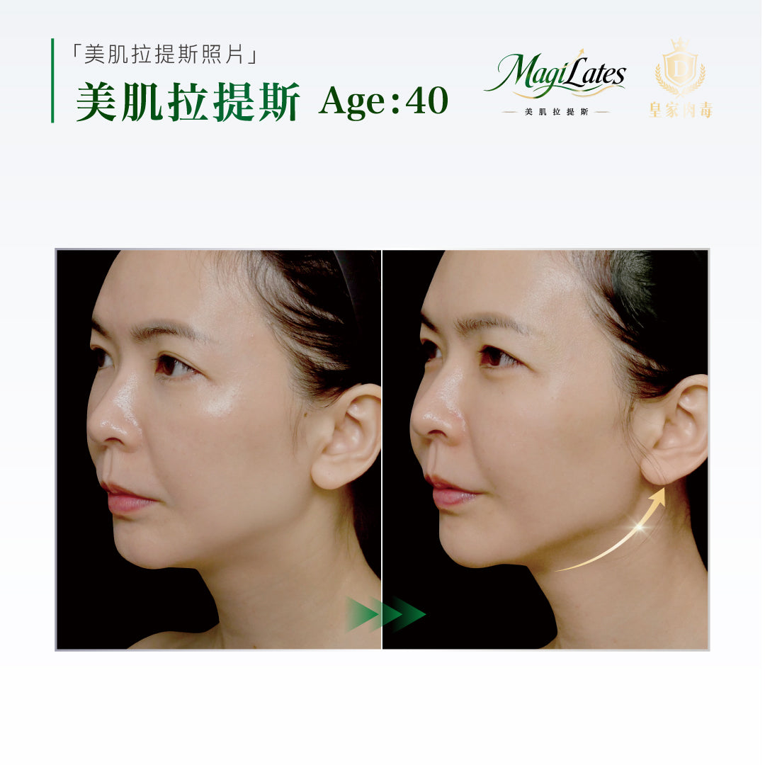 美肌拉提斯療程圖解與案例，第 3 頁